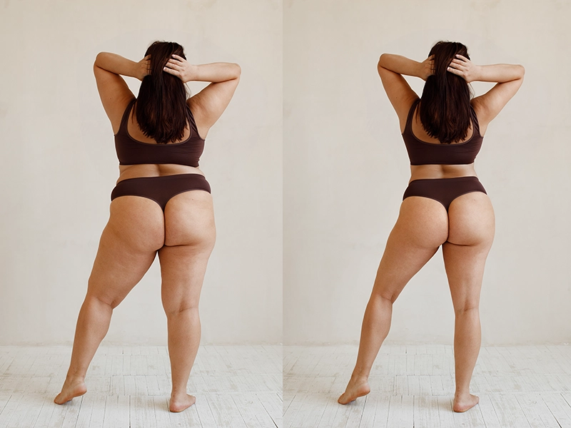 Before and after body retouching of woman body